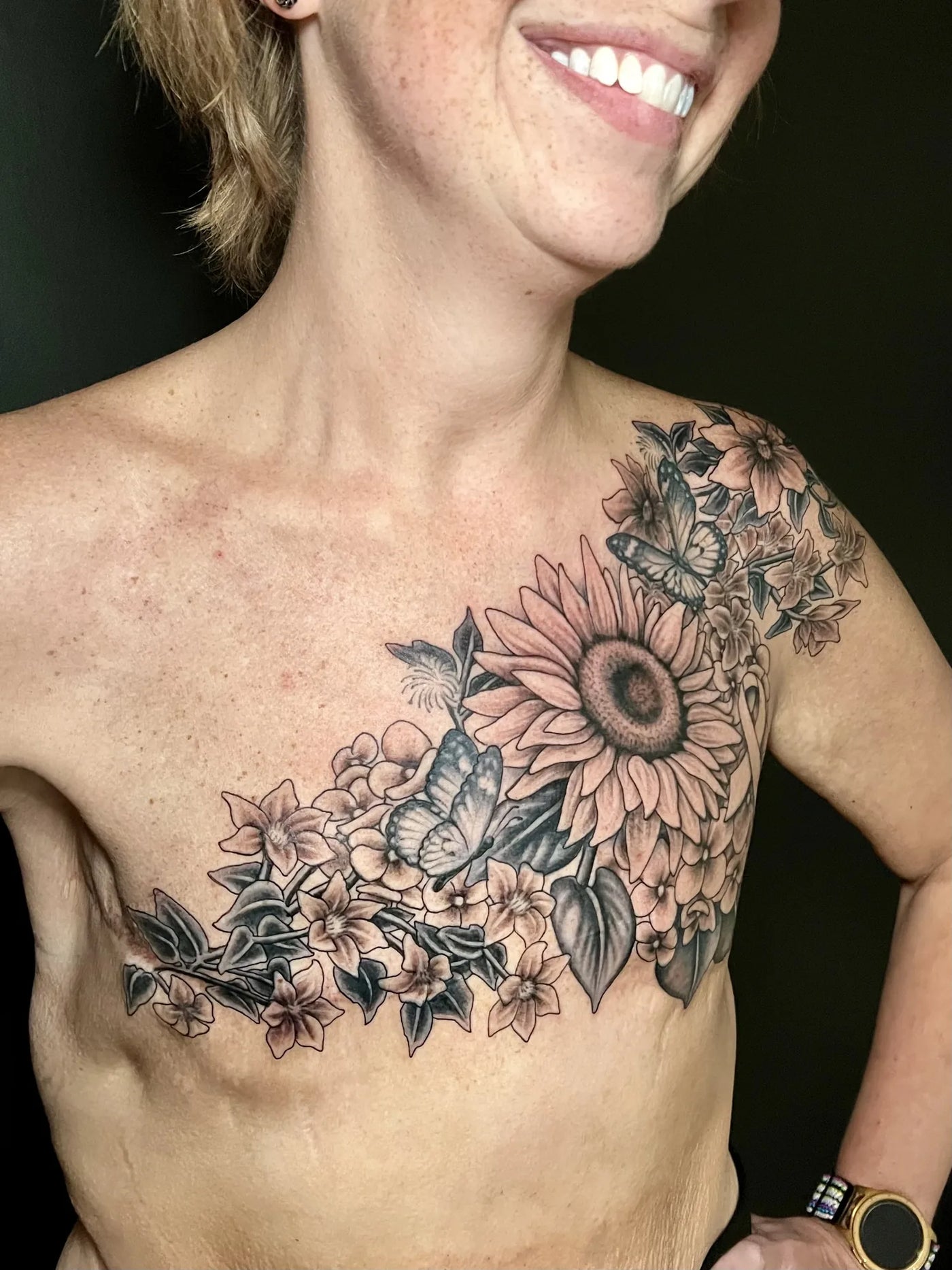 Post Mastectomy Transformation