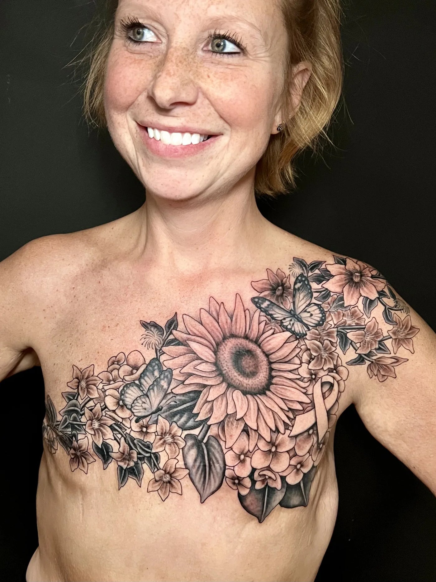 Post Mastectomy Transformation