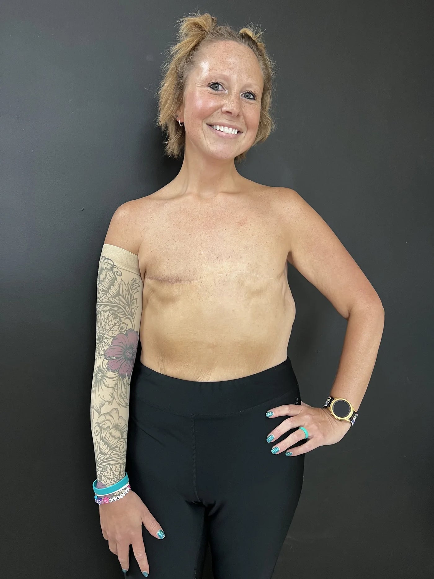 Post Mastectomy Transformation
