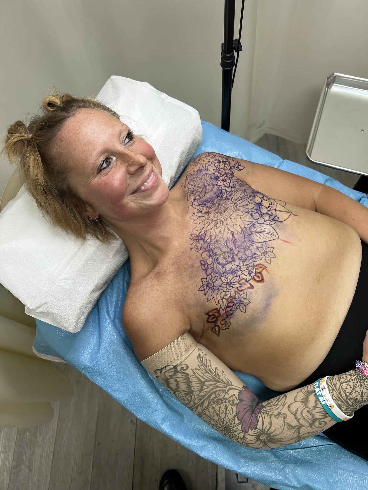 Post Mastectomy Transformation